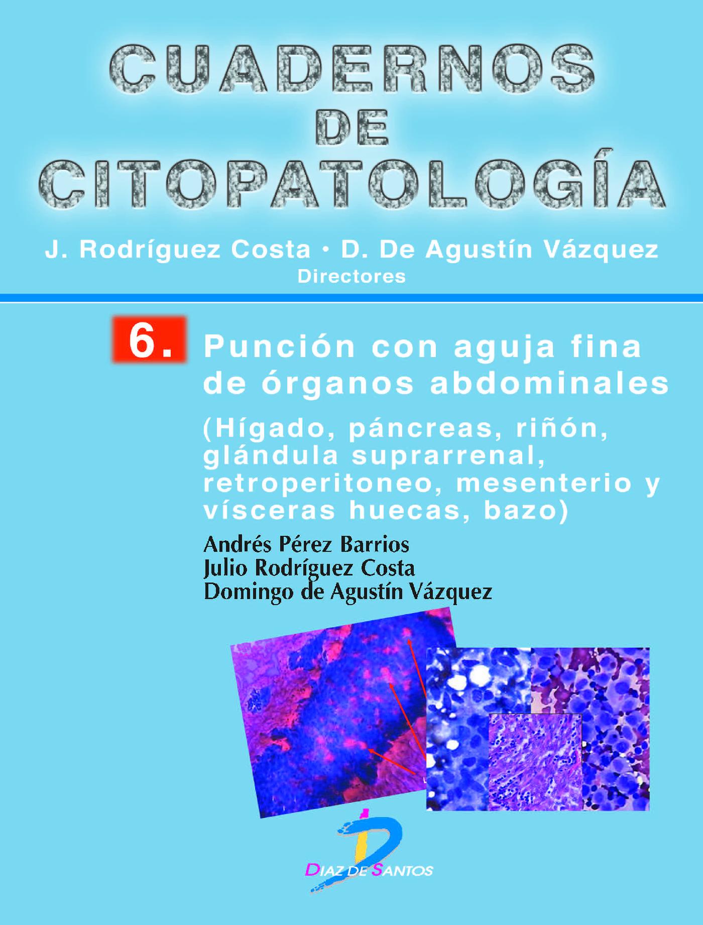 PUNCIÓN CON AGUJA FINA DE ÓRGANOS ABDOMINALES