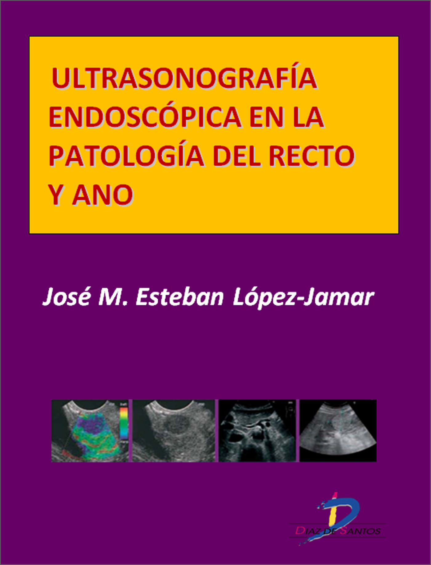 ULTRASONOGRAFÍA ENDOSCÓPICA EN LA PATOLOGÍA DEL RECTO Y ANO