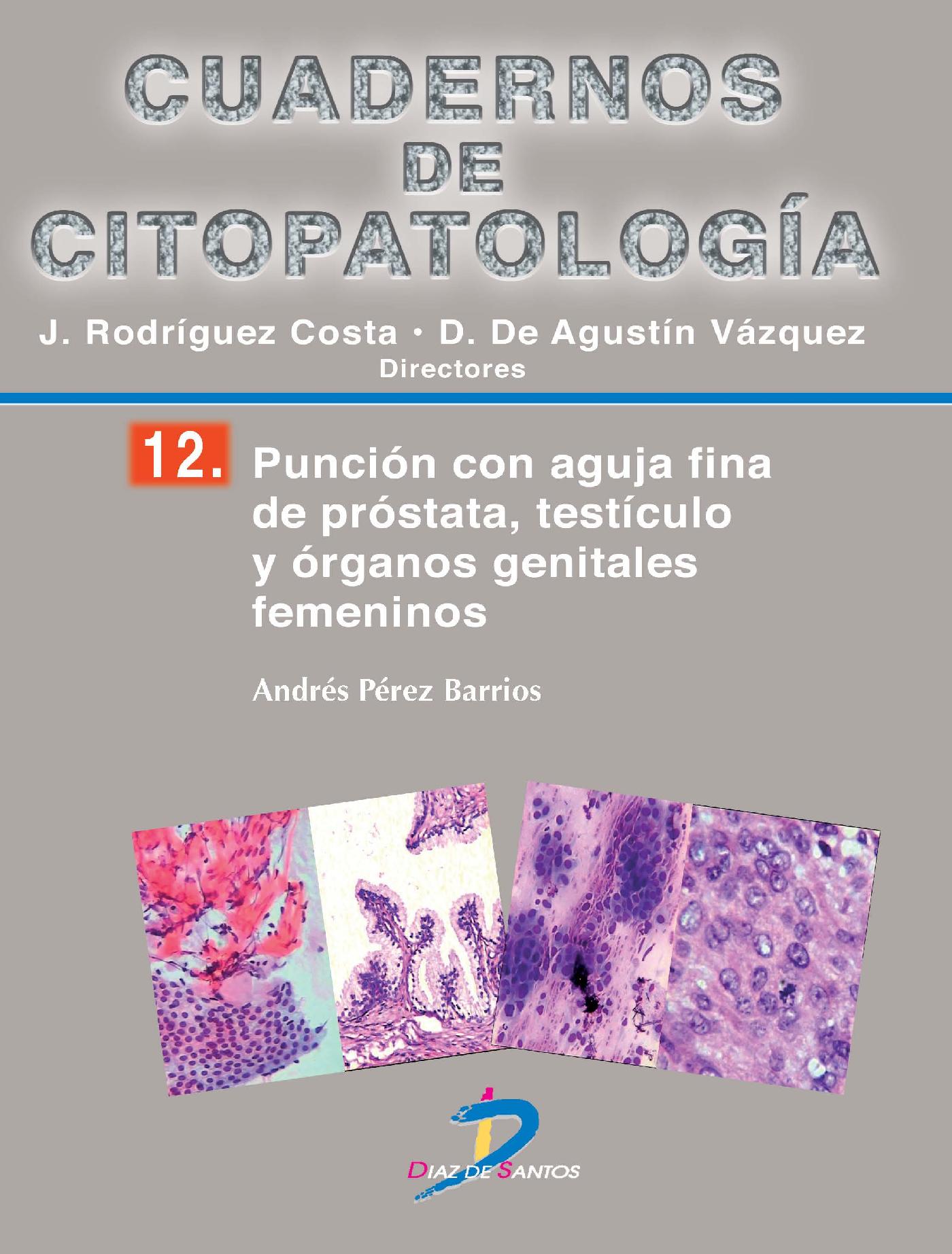 PUNCIÓN CON AGUJA FINA DE PRÓSTATA, TESTÍCULO Y ÓRGANOS GENITALES FEMENINOS