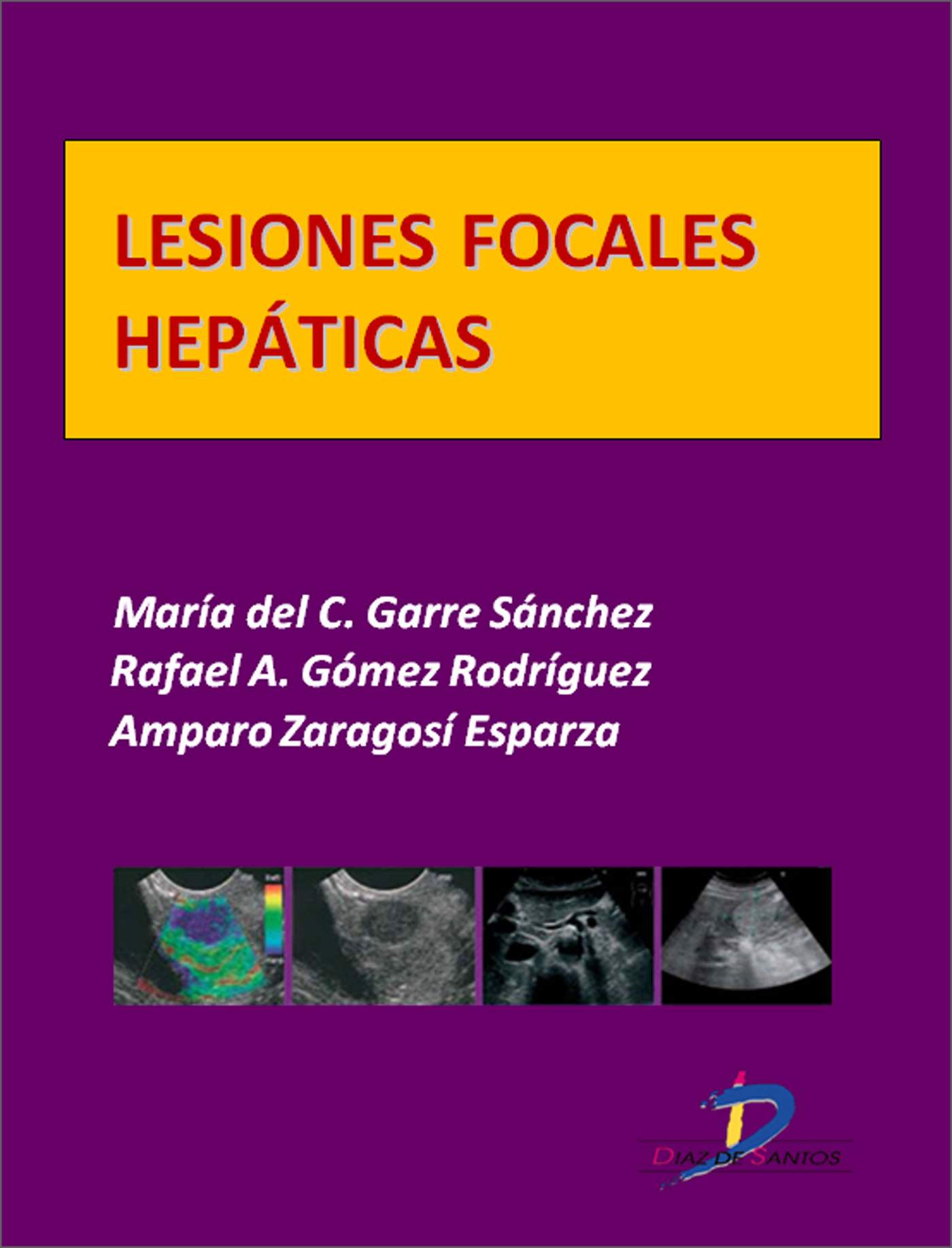LESIONES FOCALES HEPÁTICAS