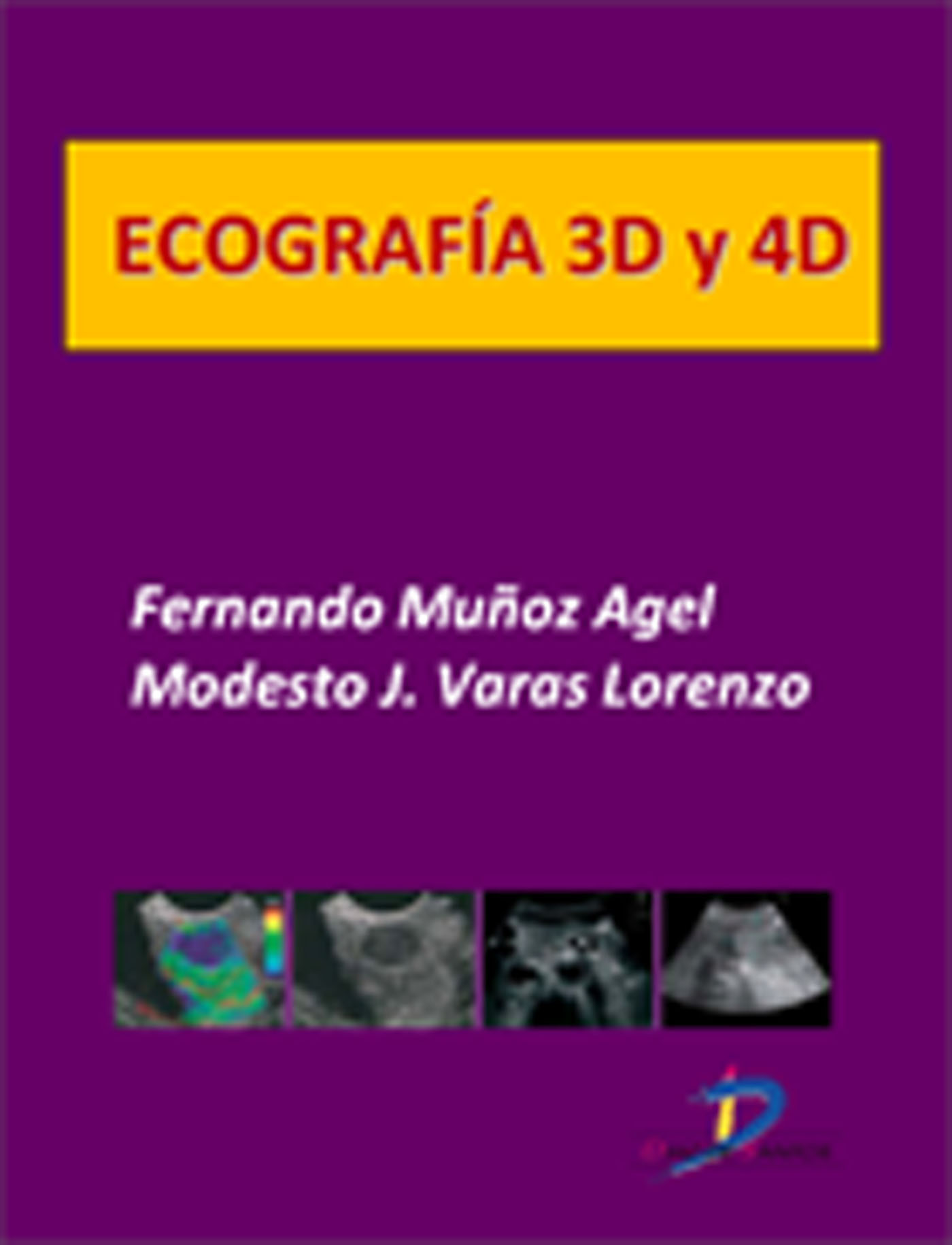 ECOGRAFÍA 3D Y 4D