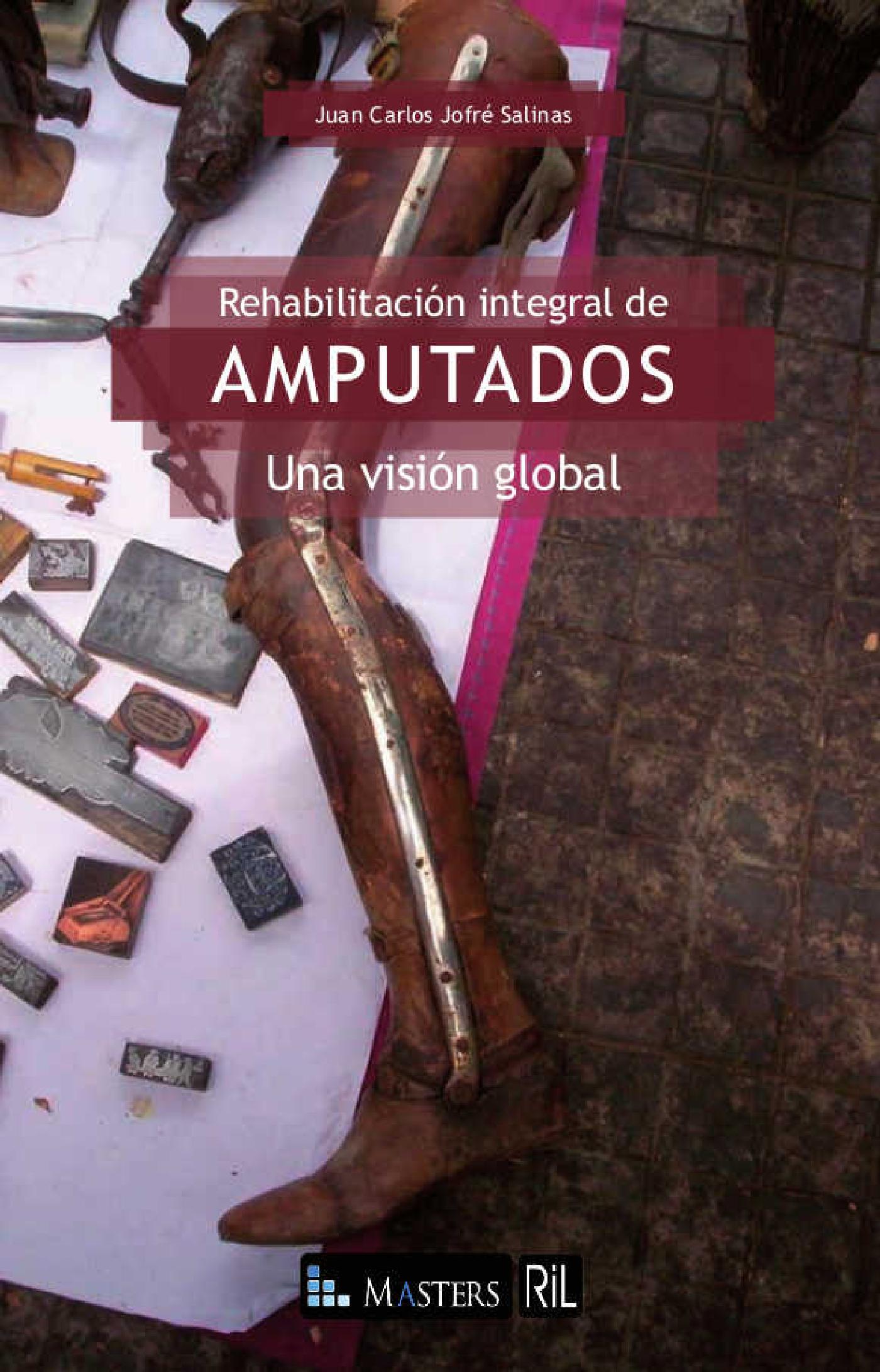 REHABILITACIÓN INTEGRAL DE AMPUTADOS: UNA VISIÓN GLOBAL