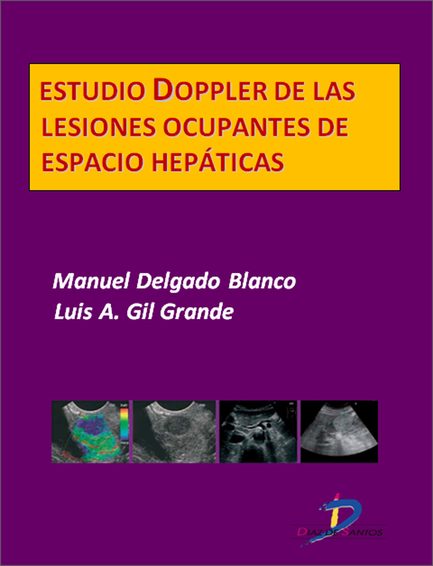 ESTUDIO DOPPLER DE LAS LESIONES OCUPANTES DE ESPACIO HEPÁTICAS