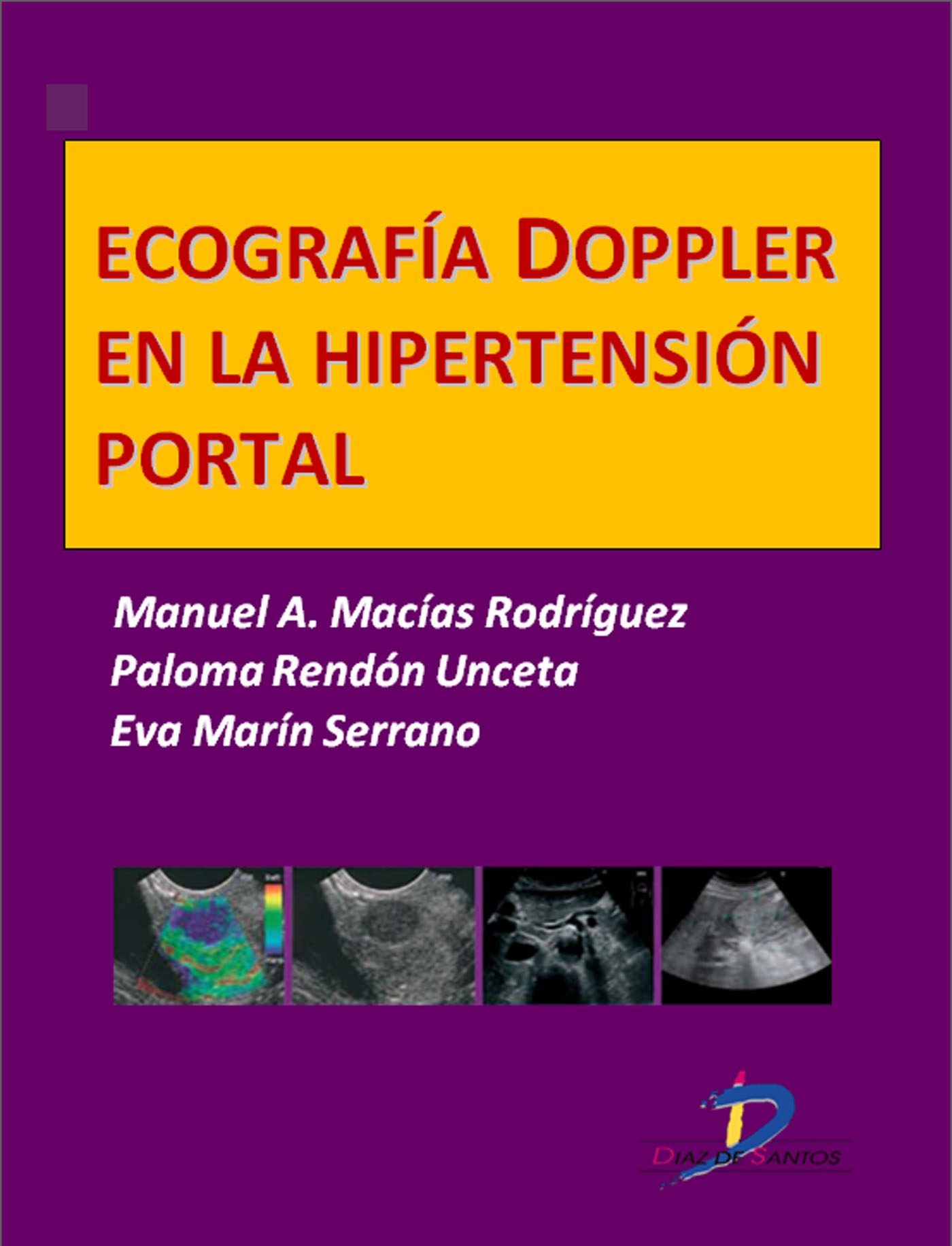 ECOGRAFÍA DOPPLER EN LA HIPERTENSIÓN PORTAL