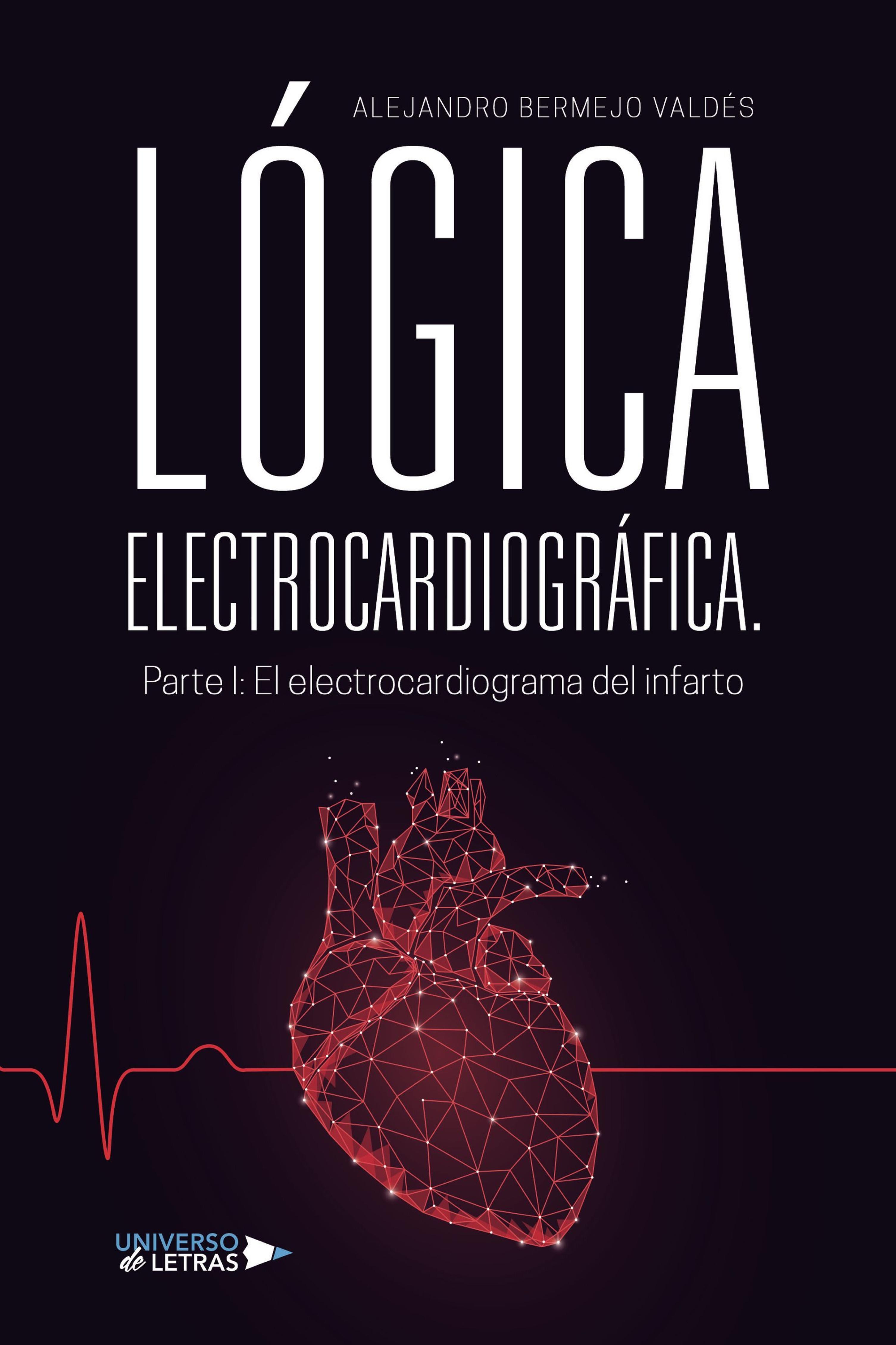 LÓGICA ELECTROCARDIOGRÁFICA. PARTE I: EL ELECTROCARDIOGRAMA DEL INFARTO