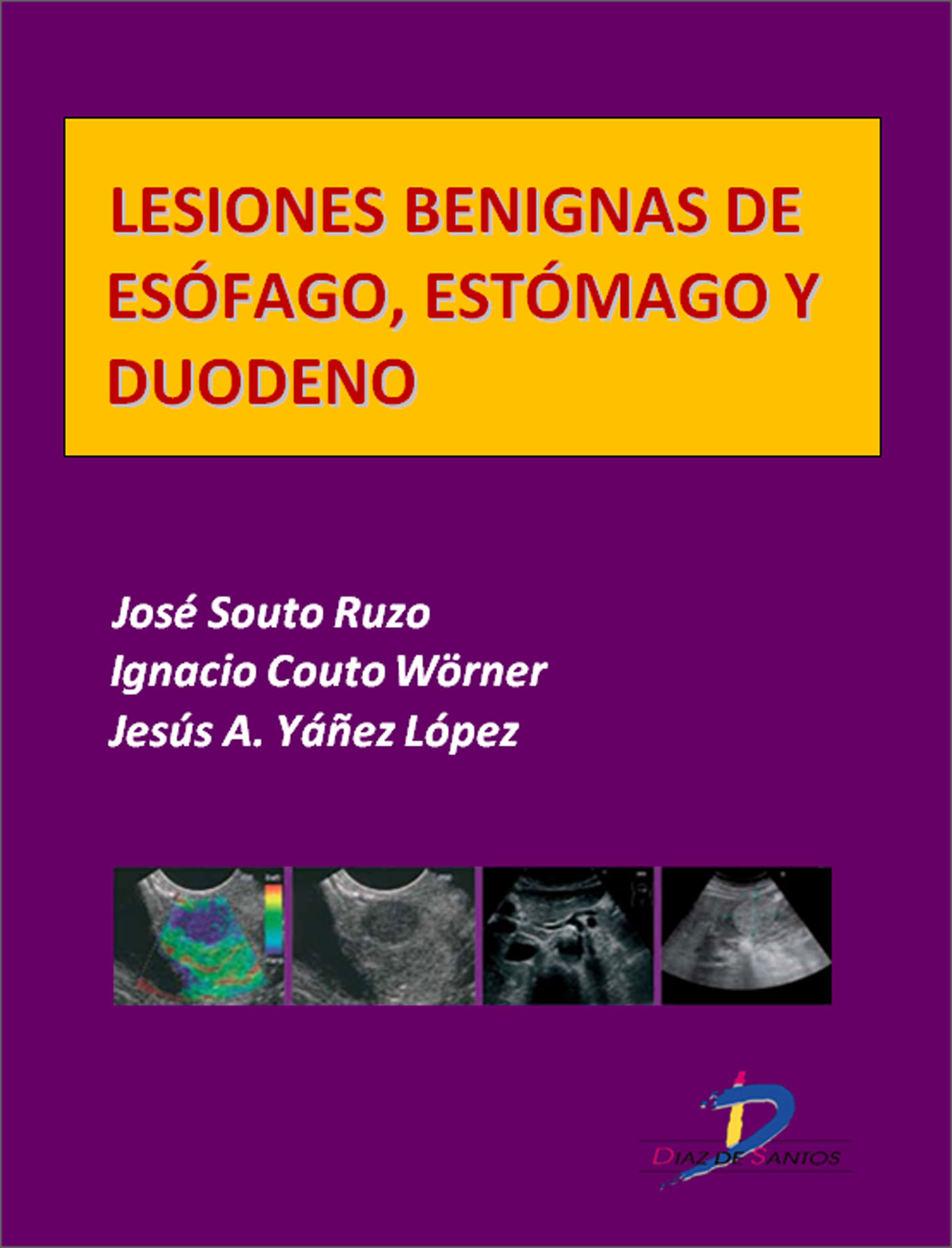 LESIONES BENIGNAS DE ESOFÁGO, ESTÓMAGO Y DUODENO