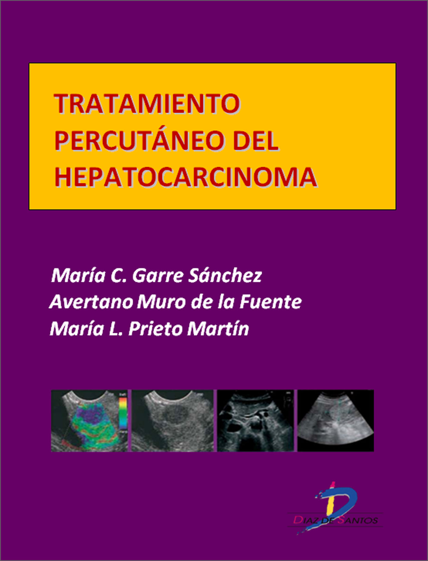 TRATAMIENTO PERCUTÁNEO DEL HEPATOCARCINOMA