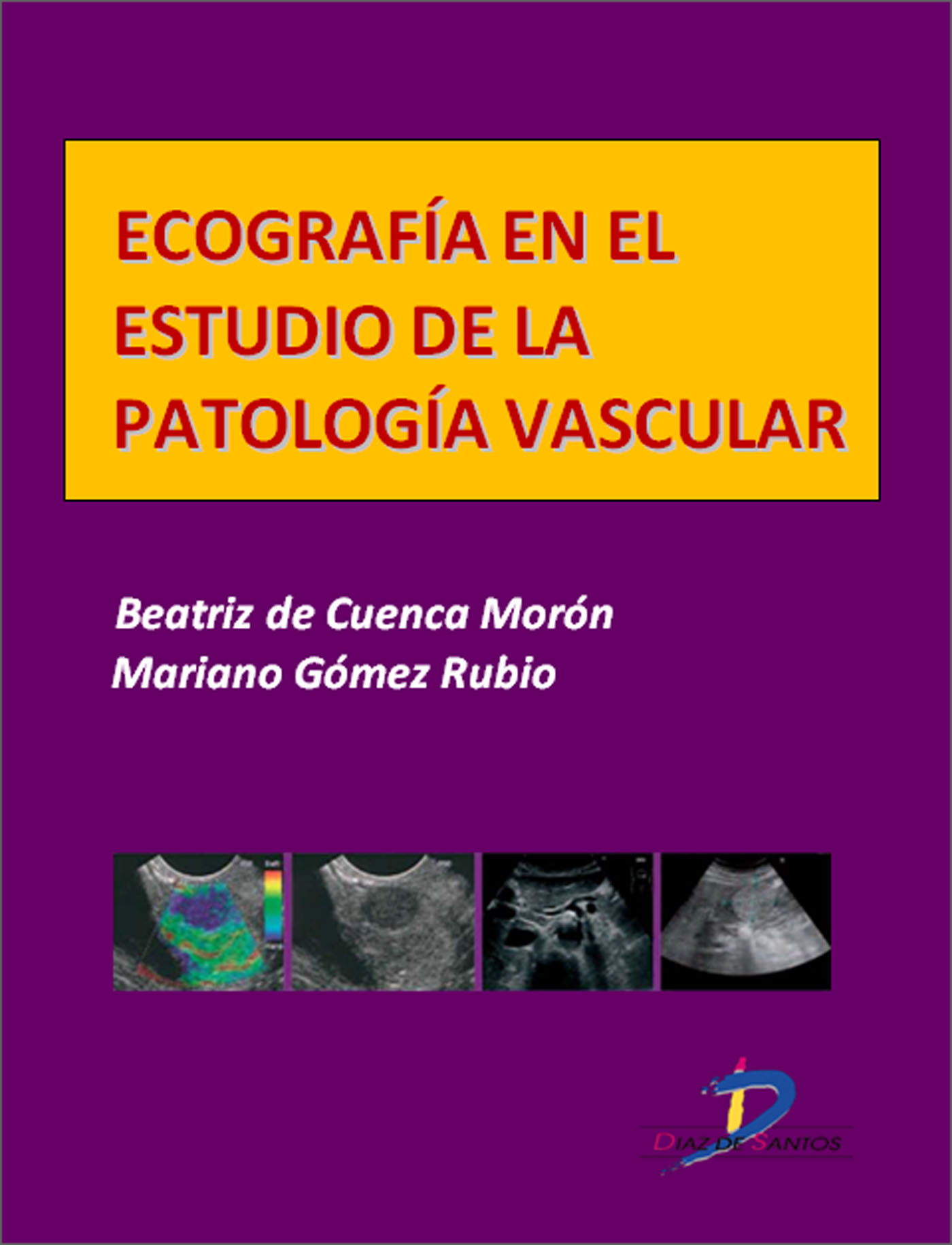 ECOGRAFÍA EN EL ESTUDIO DE LA PATOLOGÍA VASCULAR
