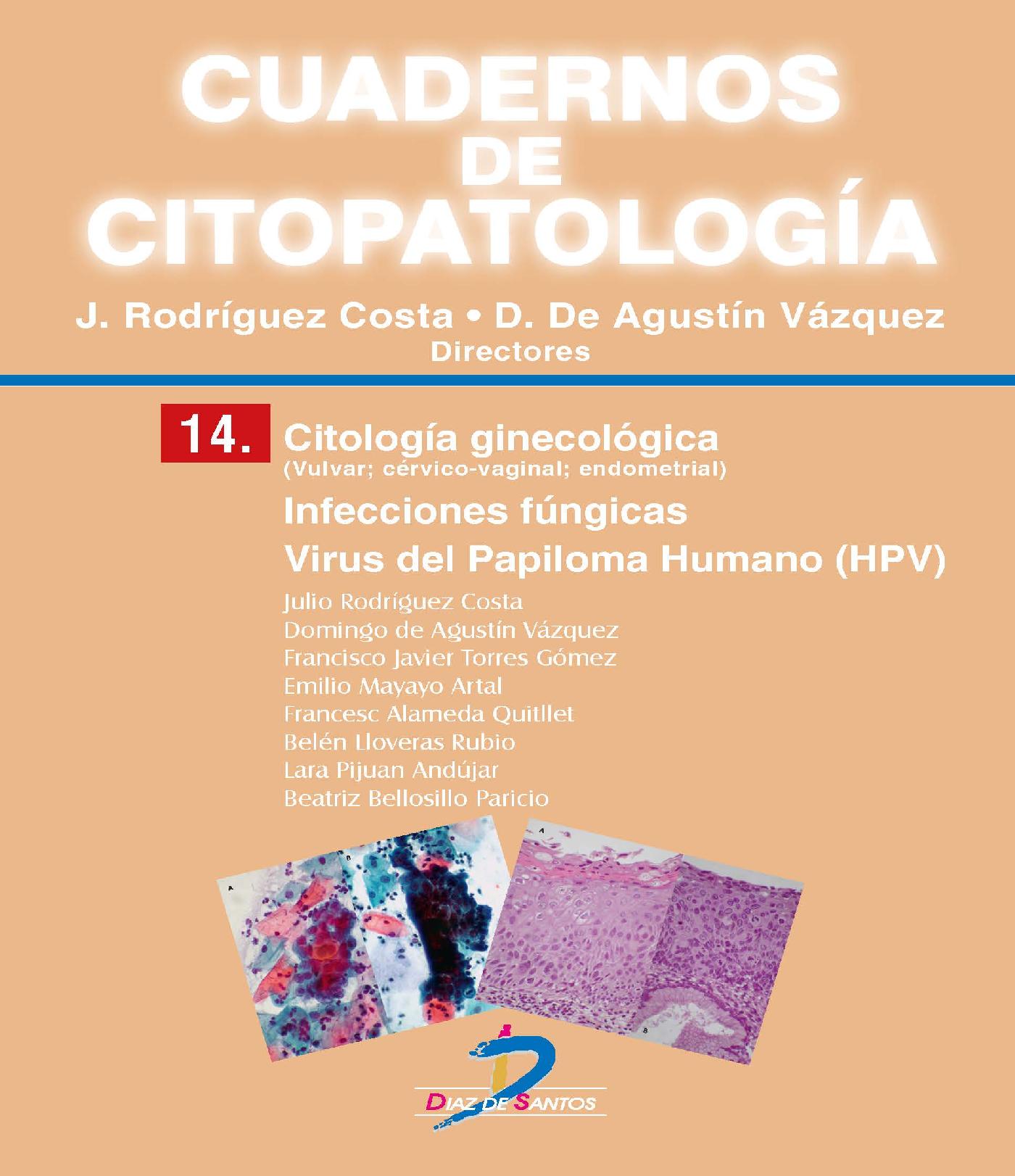 CITOLOGÍA GINECOLÓGICA. INFECCIONES FÚNGICAS. VIRUS DEL PAPILOMA HUMANO