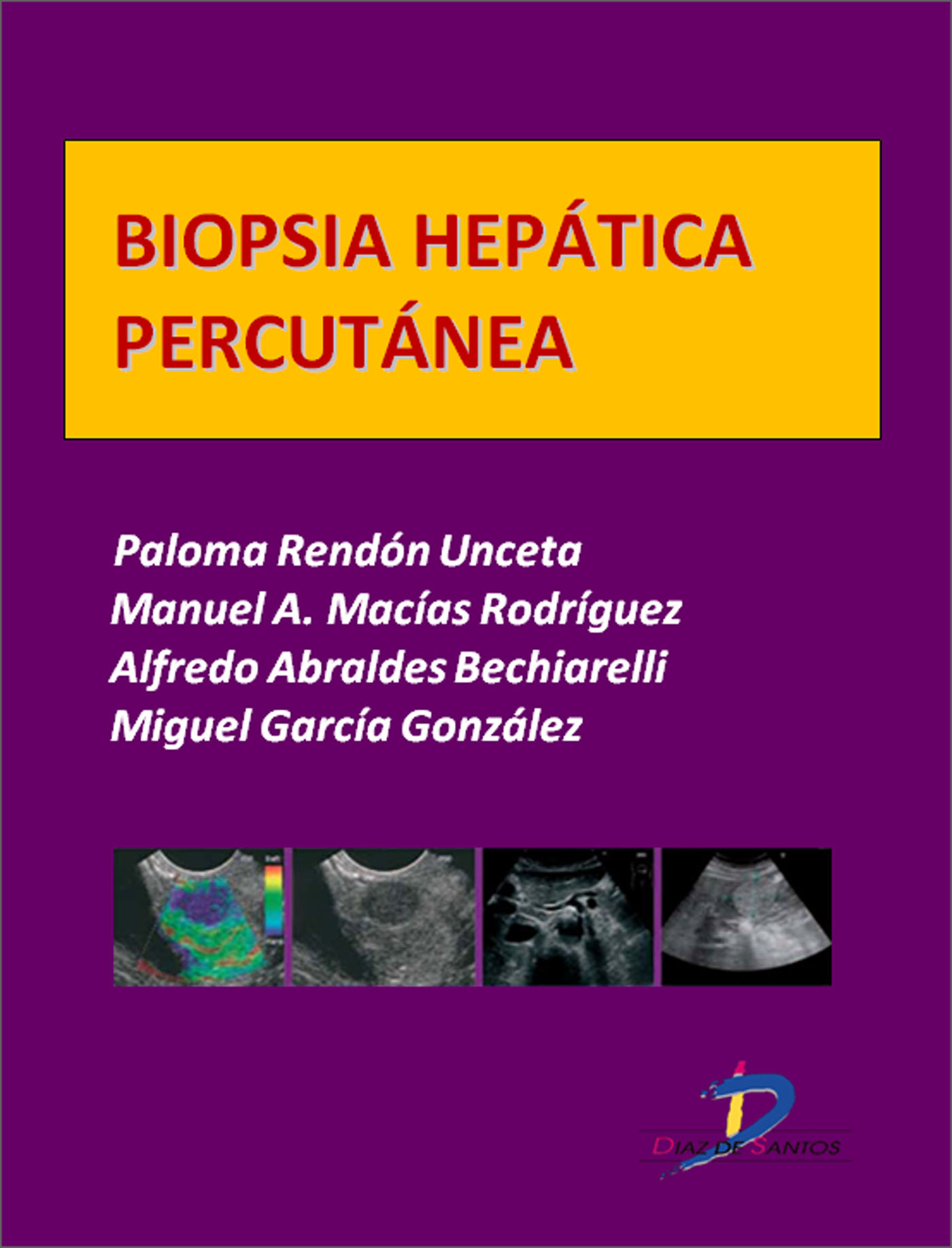 BIOPSIA HEPÁTICA PERCUTÁNEA