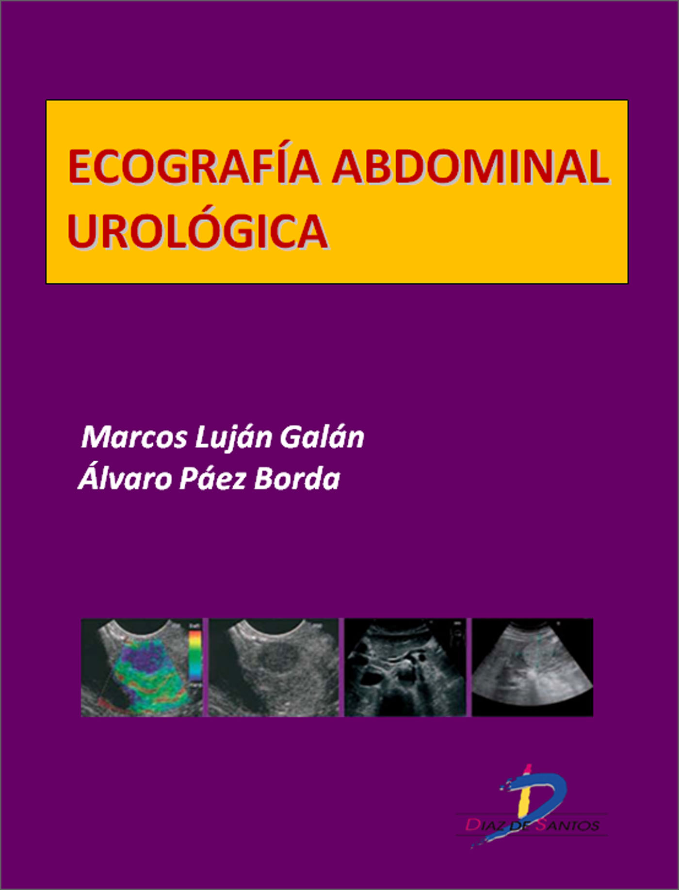ECOGRAFÍA ABDOMINAL UROLÓGICA