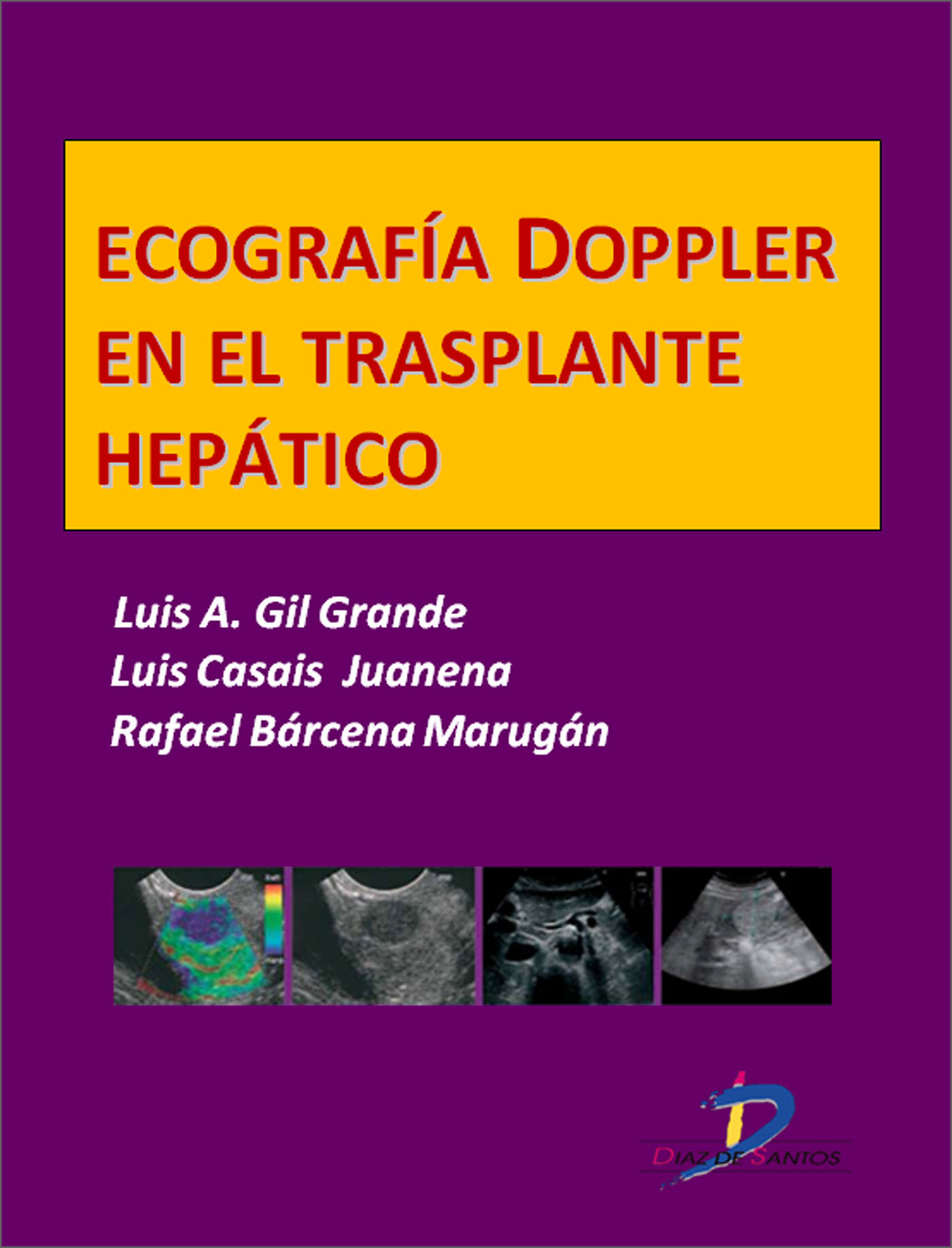 ECOGRAFÍA DOPPLER EN EL TRASPLANTE HEPÁTICO