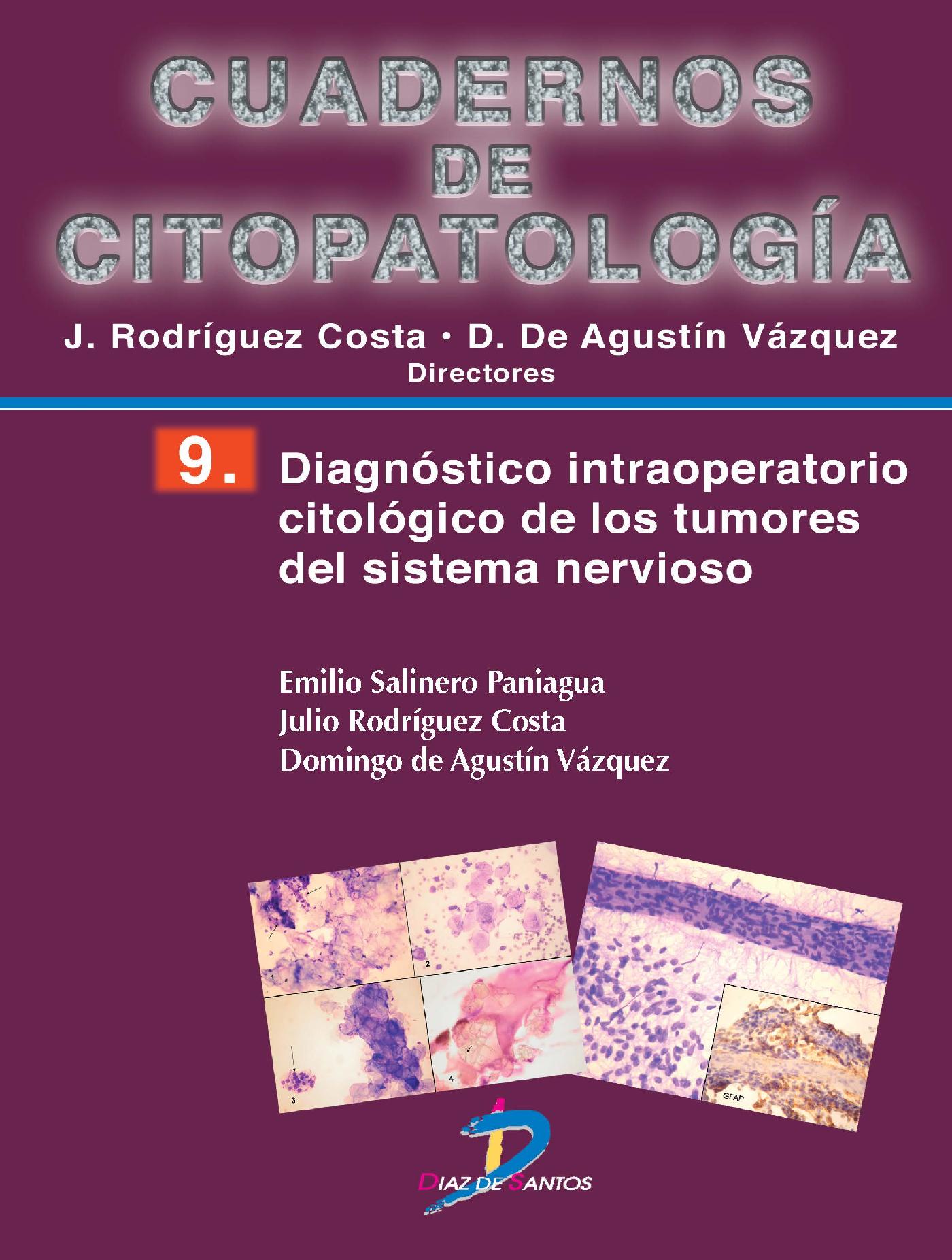 DIAGNÓSTICO INTRAOPERATORIO CITOLÓGICO DE LOS TUMORES DEL SISTEMA NERVIOSO