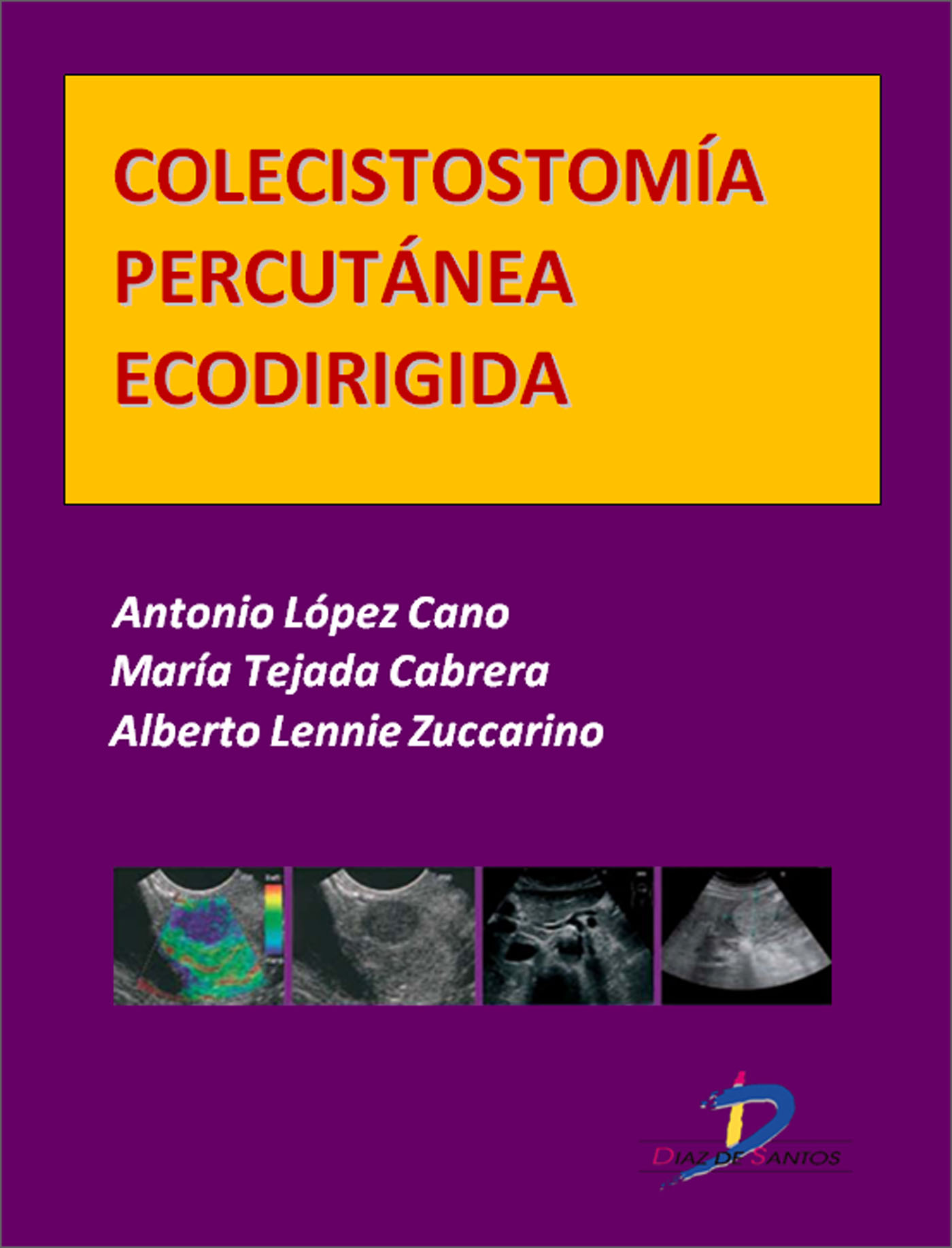 COLECISTOSTOMÍA PERCUTÁNEA ECODIRIGIDA