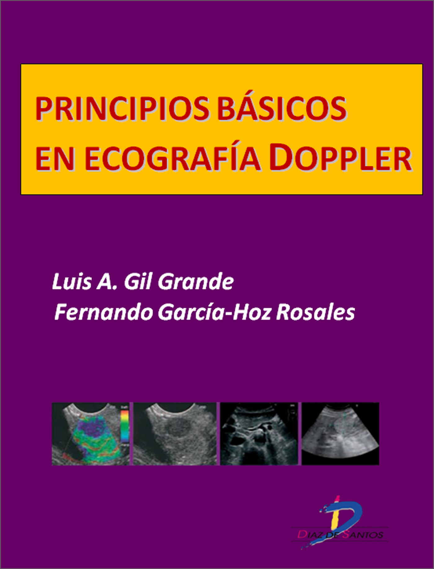 PRINCIPIOS BÁSICOS EN ECOGRAFÍA DOPPLER