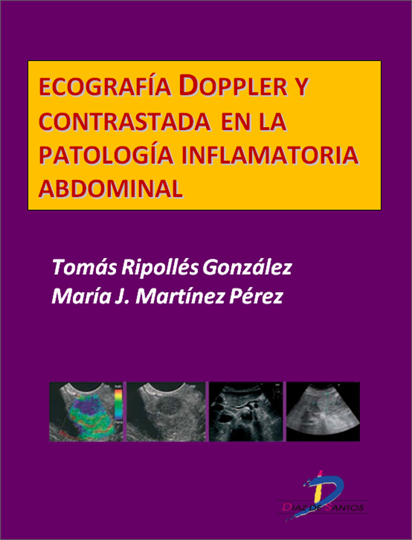 ECOGRAFÍA DOPPLER Y CONTRASTADA EN LA PATOLOGÍA INFLAMATORIA ABDOMINAL