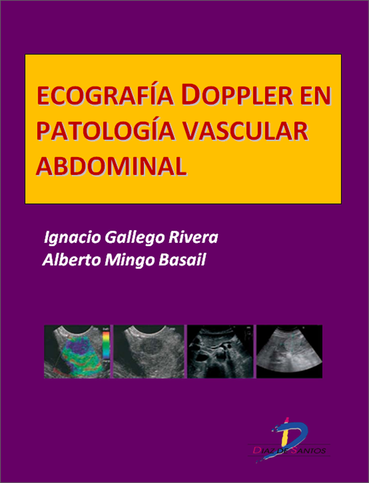 ECOGRAFÍA DOPPLER EN PATOLOGÍA VASCULAR ABDOMINAL