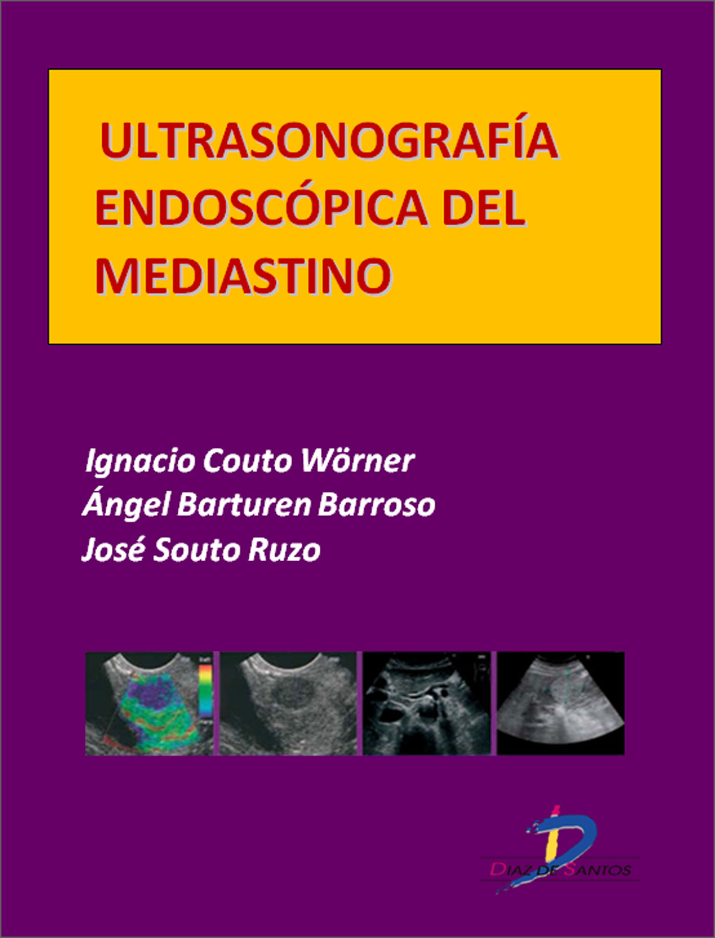 ULTRASONOGRAFÍA ENDOSCÓPICA DEL MEDIASTINO