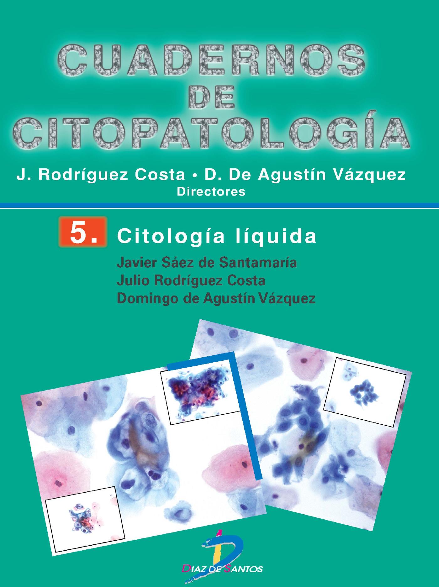 CITOLOGÍA LÍQUIDA