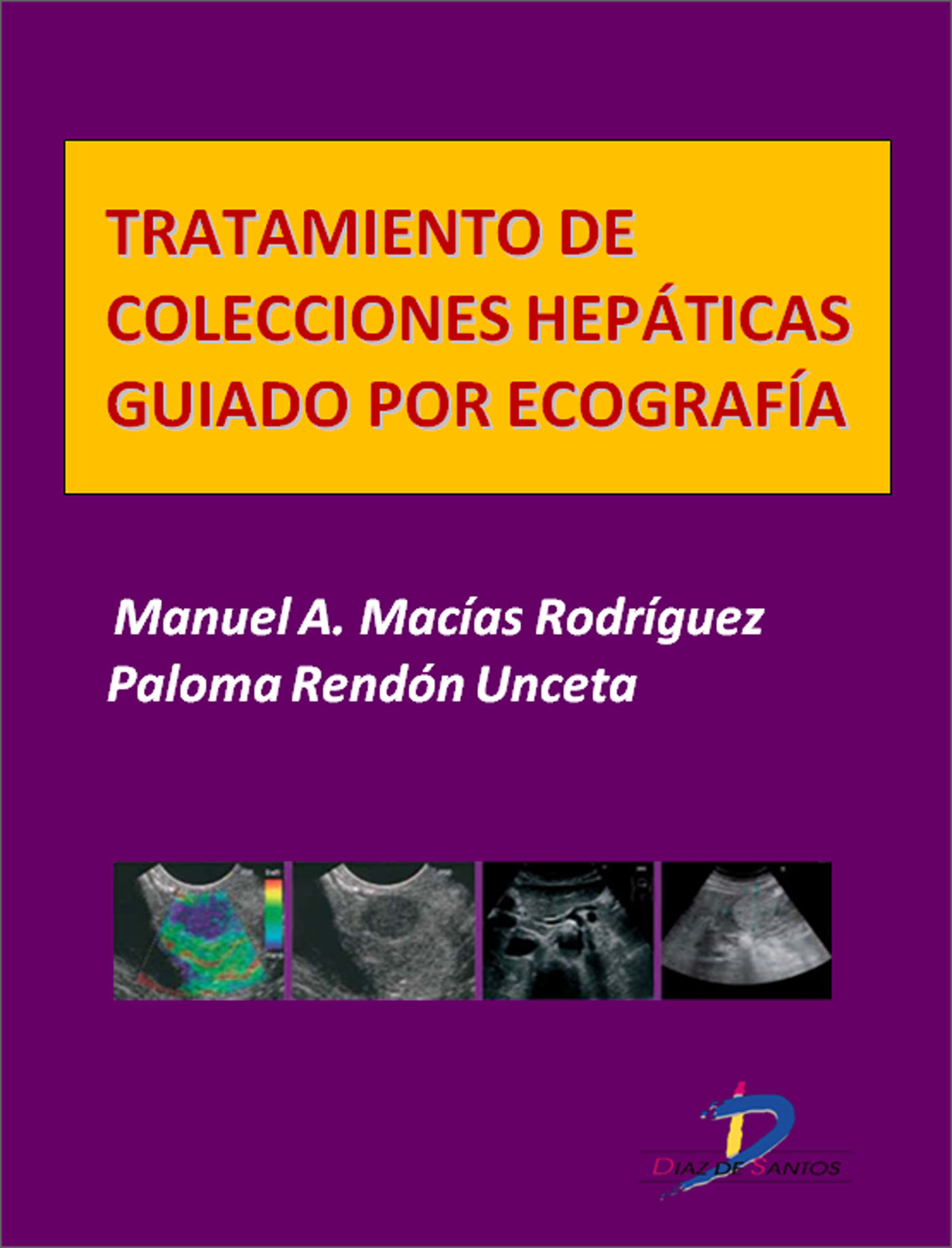 TRATAMIENTO DE COLECCIONES HEPÁTICAS GUIADO POR ECOGRAFÍA